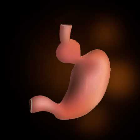 Hiatal Hernia Repair Hiatal Hernia Repair